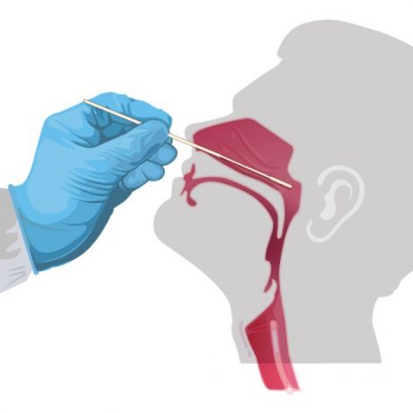 YLab180 Throat Swab